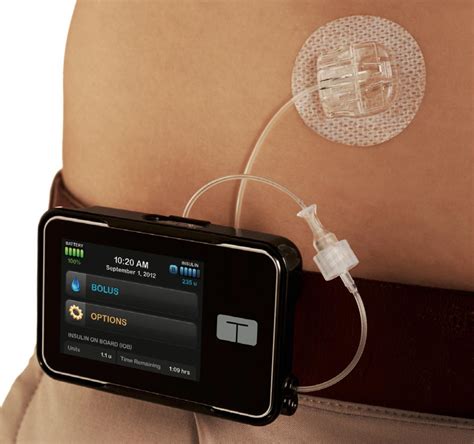 t slim tandem insulin pump