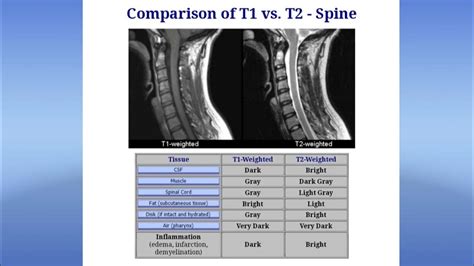 T1/2 Vs 1/A^2
