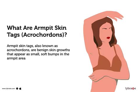 Tags In Armpits