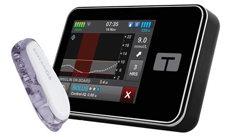 tandem insulin pump technical support