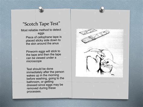 Tape Test for Pinworms: A Simple Home Screening Method