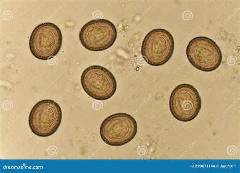 Tapeworm Eggs In Stool