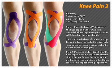 taping for runners knee