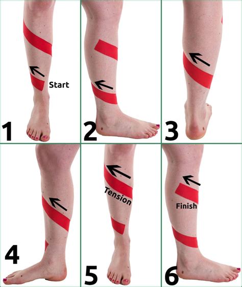 Taping Up For Shin Splints