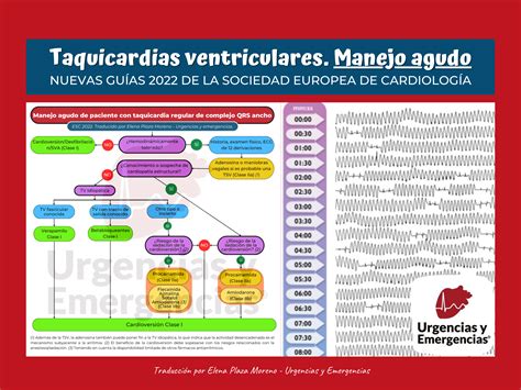 taquicardia supraventricular pdf 2022