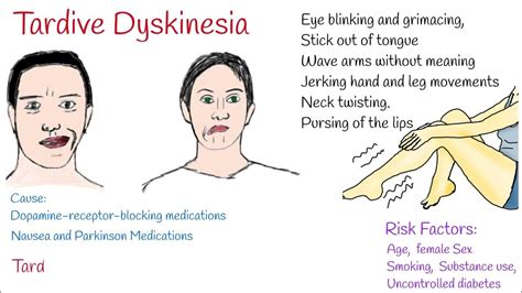 tardive dyskinesia vs subacute dyskinesia