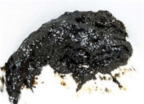 Tarry Define Medical