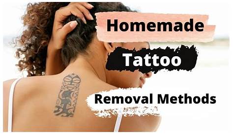 Tattoo Removal At Home Methods TCA 50 1st Application Part 1 Of