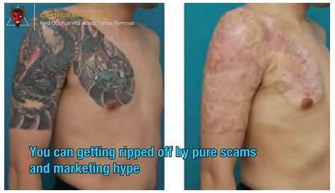Tattoo Removal Berlin Price Artist Specializes In Left Handed Style Of ing