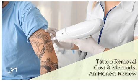 Tattoo Removal Cost Miami How Much Does Zerkalovulcan