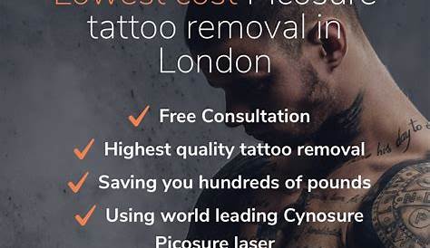 Tattoo Removal Experts London Who Seeks Laser ? Connecticut