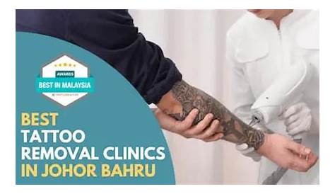 8 Best Tattoo Removal Clinics in Johor Bahru [2023] FunEmpire