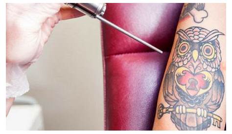 Tattoo Removal Training Toronto The Importance Of HandsOn Laser New Look