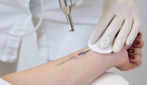 Tattooing Procedure - The 411 on How It's Done