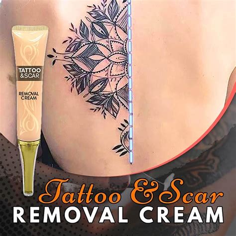 Tattoo Removal Cream: The Latest Technology In Tattoo Removal