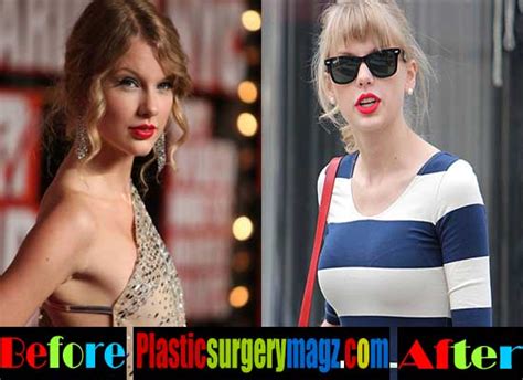 Controversy or Cosmetic Choice Taylor Swift's Transformation Debated