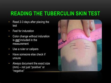 Understanding TB Skin Test Reading: A Comprehensive Guide