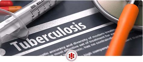 tb testing el paso tx