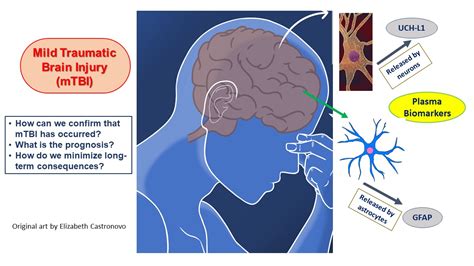 Clear Guide to TBI Test Reimbursement: Get Your Due Back!