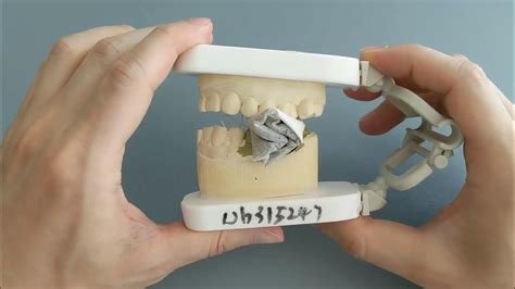 Tea Bag Wisdom Teeth Bleeding