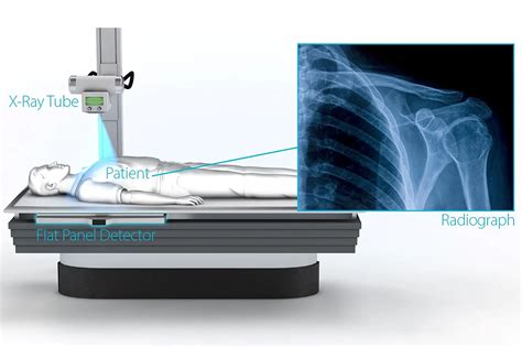Unveiling Technology X Ray Innovations: What's Next in Medical Imaging?