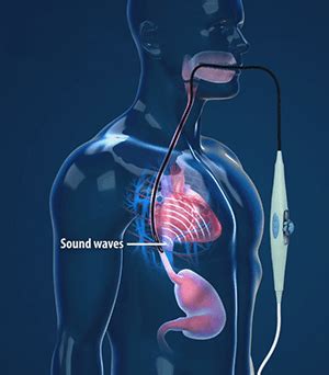 tee medical abbreviation cardiology