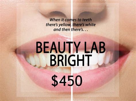 Salt Lake City Teeth Whitening Utah Professional Teeth Whitening