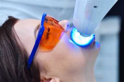 Teeth Bleaching By Laser