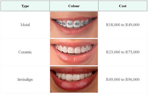 Teeth Braces Cost In Namibia