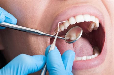teeth cleaning boise