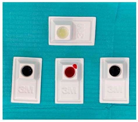 Teeth Color Detector