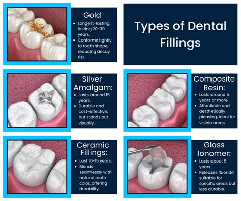 Teeth Filling Names