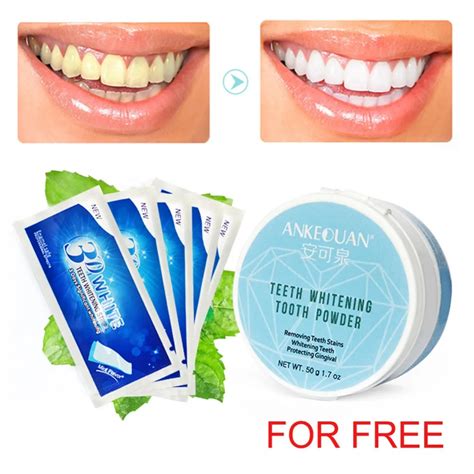 Teeth Whitening Kit Aliexpress
