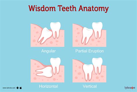 teeth with wisdom teeth