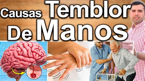 temblor de manos causas