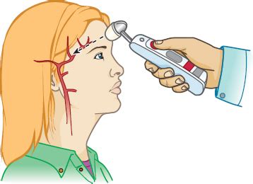 temporal artery location for thermometer