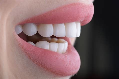 Temporary Crown Very Sensitive