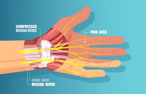 tendon damage in wrist symptoms