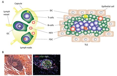 tertiary lymphoid structures signature tls