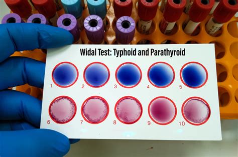tes widal