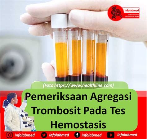 test agregasi trombosit
