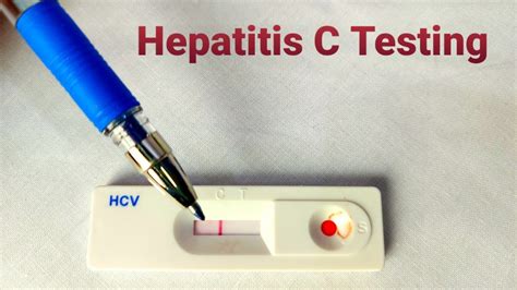 test auf hepatitis c