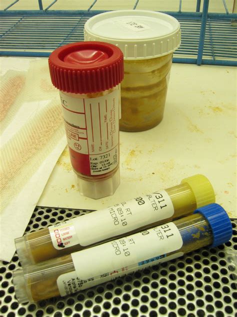 Test On Stool Samples