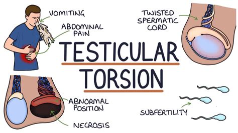 testicular torsion how to fix