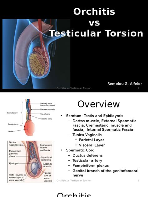 testicular torsion vs orchitis