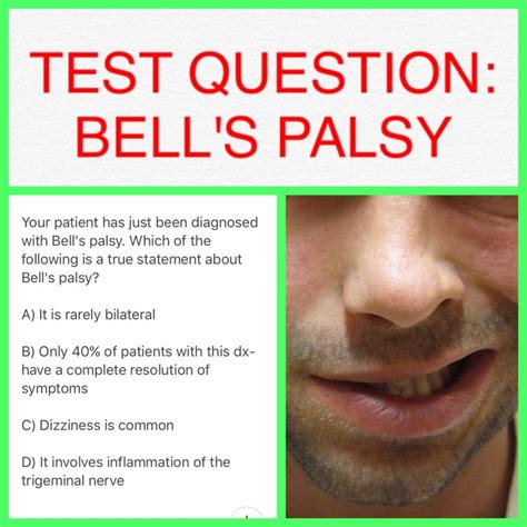 testing for bell's palsy