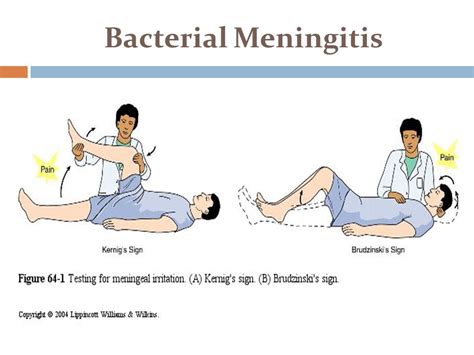 testing for meningitis physical exam