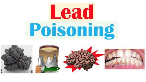 The Symptoms Of Lead Poisoning Explained