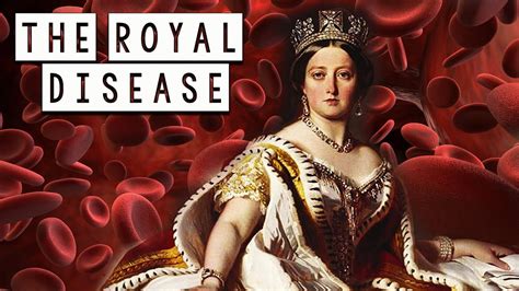 the royal disease hemophilia
