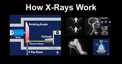 How X Rays Work: The Science Behind Radiation Imaging
